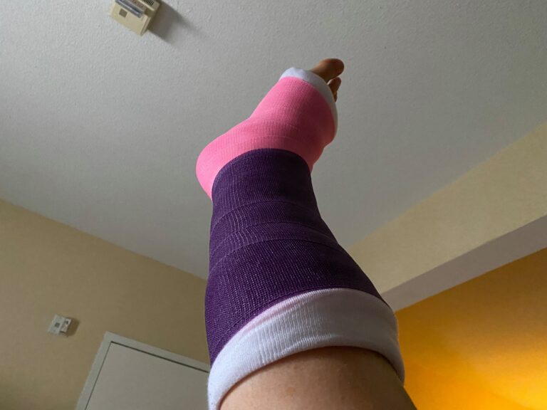 I broke my leg (well, broke my foot OFF my leg) in Maine… Read the saga here. (Now I need some help. Can you help me get home?)