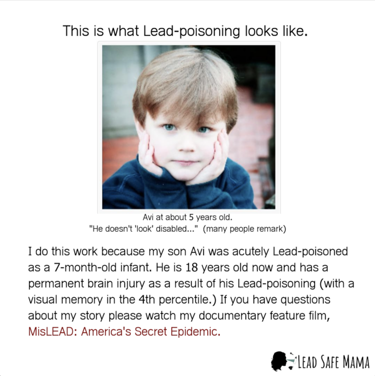 This is what #LeadPoisoning looks like.